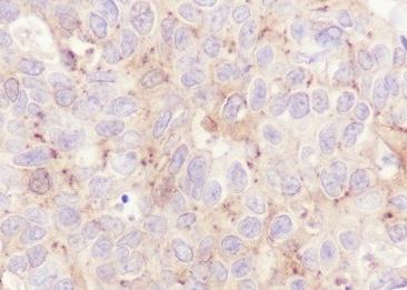Recombinant ALIX Monoclonal Antibody-searchlist-2