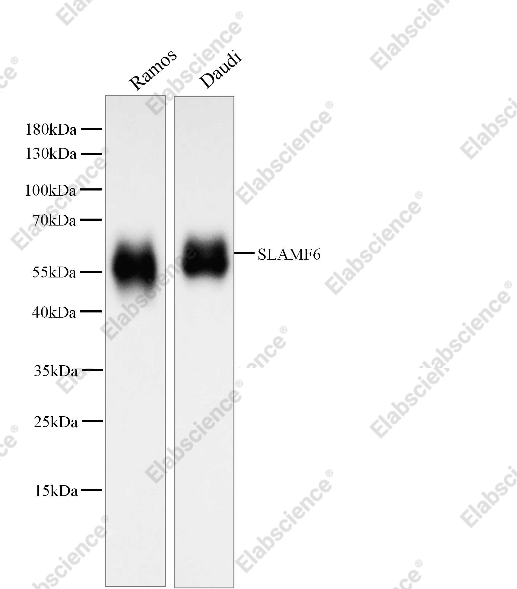 Recombinant Ly108/SLAMF6 Monoclonal Antibody - 1