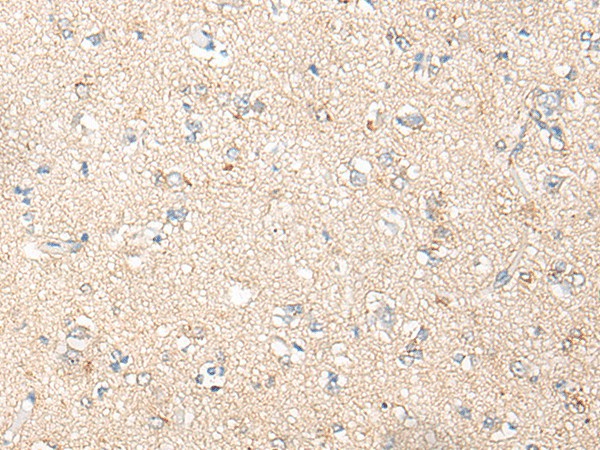 Immunohistochemistry of paraffin-embedded Human brain tissue  using PNPO Polyclonal Antibody at dilution of 1:30(?200)