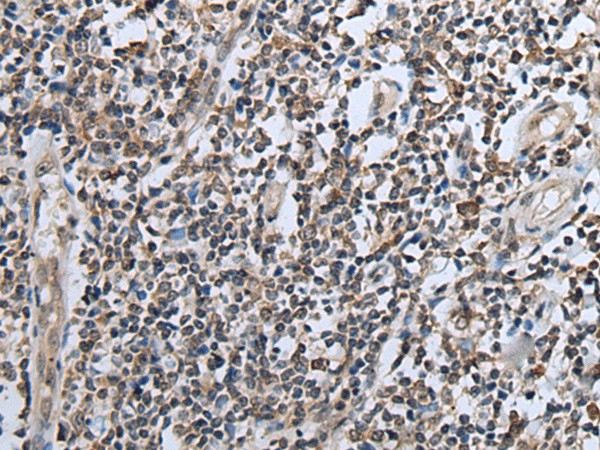 Immunohistochemistry of paraffin-embedded Human tonsil tissue  using CXCL6 Polyclonal Antibody at dilution of 1:60(?200)