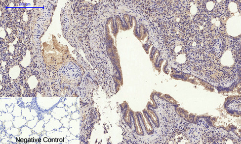 Immunohistochemistry of paraffin-embedded Rat lung tissue using GLUT-4 Polyclonal Antibody at dilution of 1:200.