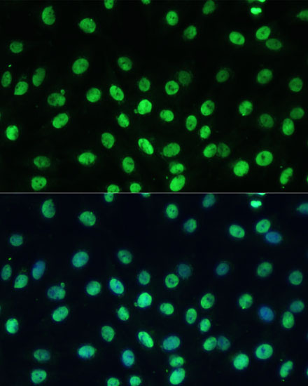 Immunofluorescence analysis of C6 cells using TRIM28 Polyclonal Antibody at dilution of  1:100 (40x lens). Blue: DAPI for nuclear staining.