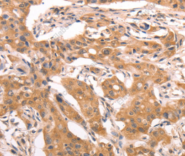 AASDHPPT Polyclonal Antibody - 3