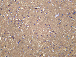 Recombinant Neurofascin Monoclonal Antibody - 1