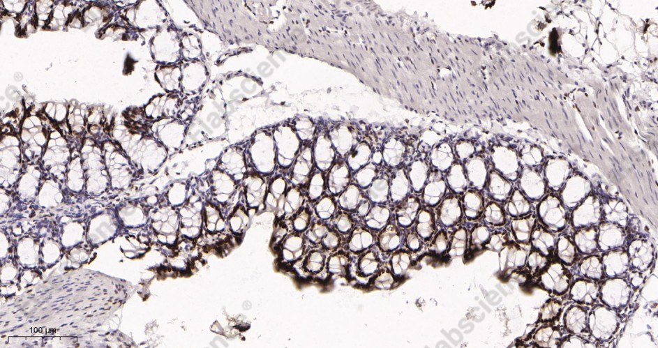 Recombinant KLF4 Monoclonal Antibody - 3