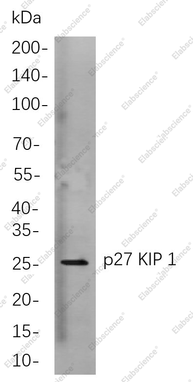 Recombinant p27 KIP 1 Monoclonal Antibody - 1