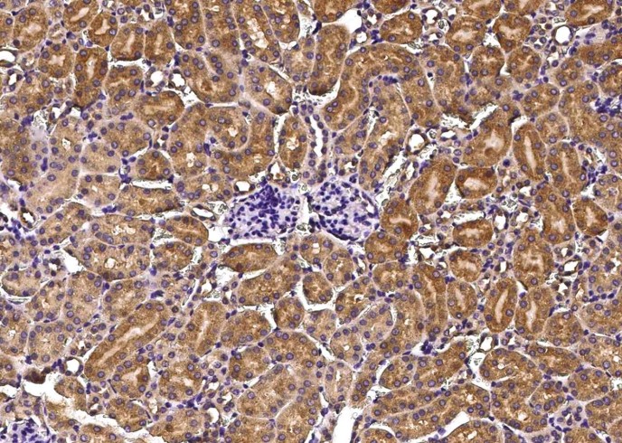 Recombinant Growth Hormone Receptor/GHR/GHBP Monoclonal Antibody - small - 2