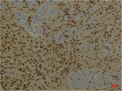 Immunohistochemistry of paraffin-embedded Mouse brain tissue using PI 3 kinase p85 alpha Monoclonal Antibody at dilution of 1:200.