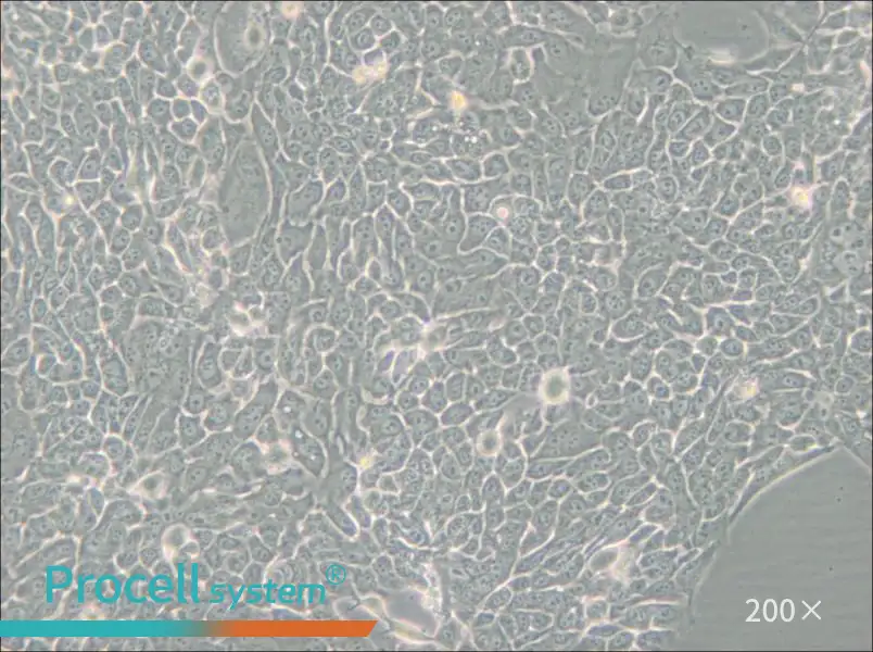 Detroit 562 Cell Complete Medium - 6