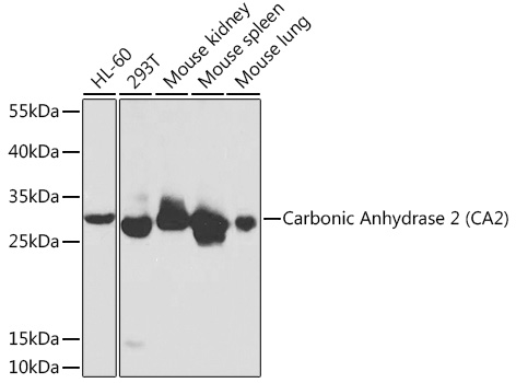 Western blot analysis of extracts of various cell lines using Carbonic Anhydrase 2 (CA2) Polyclonal Antibody at 1:1000 dilution.