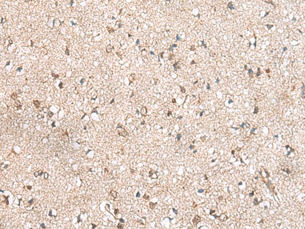 Immunohistochemistry of paraffin-embedded Human brain tissue  using RPL23A Polyclonal Antibody at dilution of 1:50(?200)