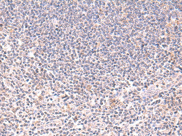 Immunohistochemistry of paraffin-embedded Human tonsil tissue  using DHPS Polyclonal Antibody at dilution of 1:75(?200)