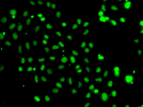 Immunofluorescence analysis of A-549 cells using HMG20A Polyclonal Antibody
