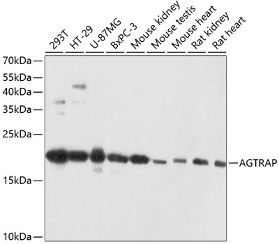 Western blot analysis of extracts of various cell lines using AGTRAP Polyclonal Antibody at dilution of 1:3000.