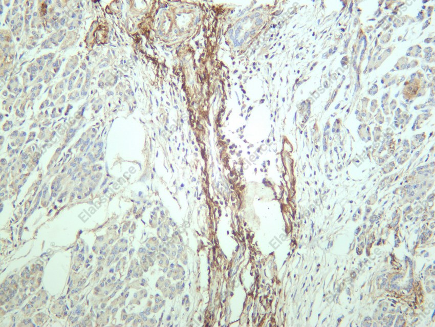 Recombinant PLCG1 Monoclonal Antibody - 3