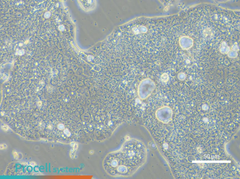 NCI-N87 [N87] - 4