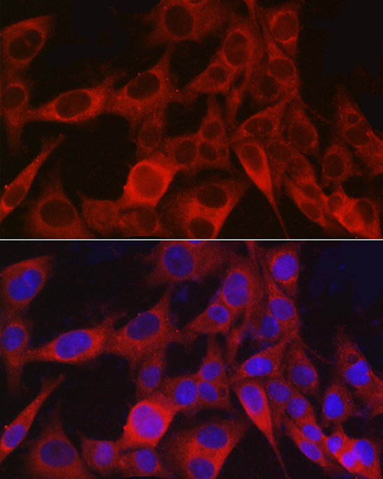 Immunofluorescence analysis of A-375 cells using [KO Validated] NG2/CSPG4 Polyclonal Antibody at dilution of 1:100 (40x lens). Blue: DAPI for nuclear staining.