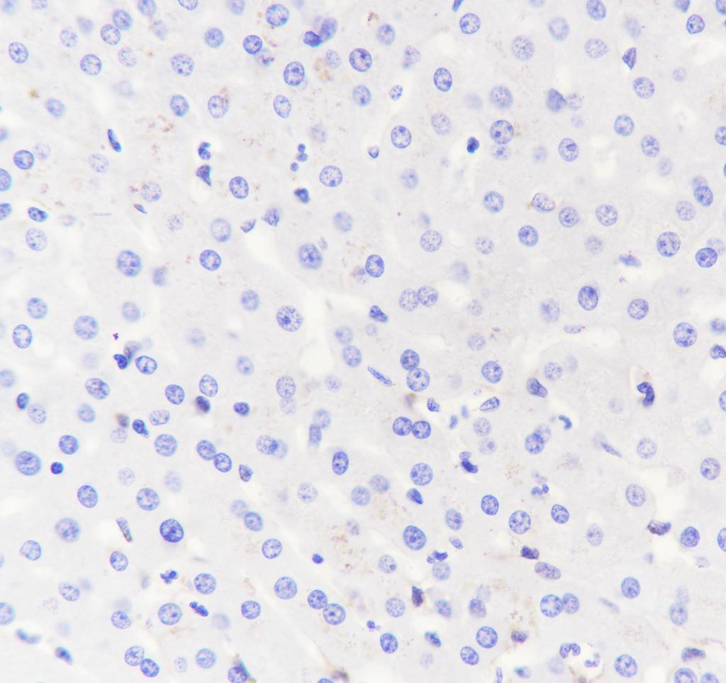 Recombinant ACE2 Monoclonal Antibody - small - 4