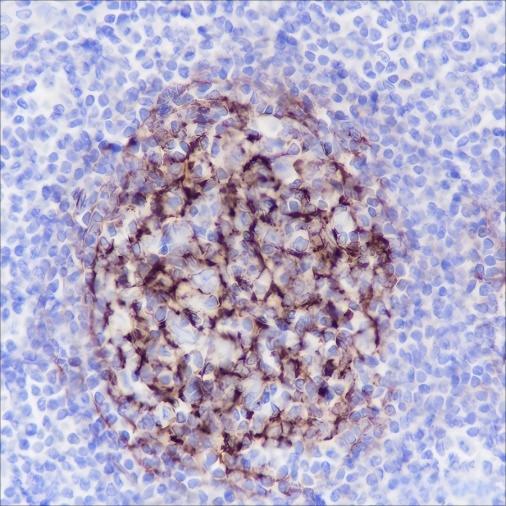 Recombinant Complement C4-B Monoclonal Antibody - small - 4