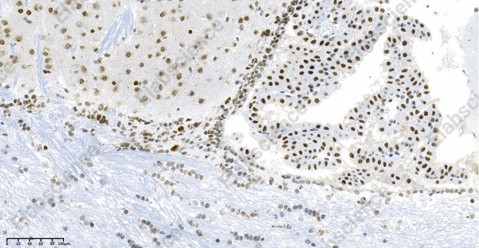 Recombinant HP1α Monoclonal Antibody - 2