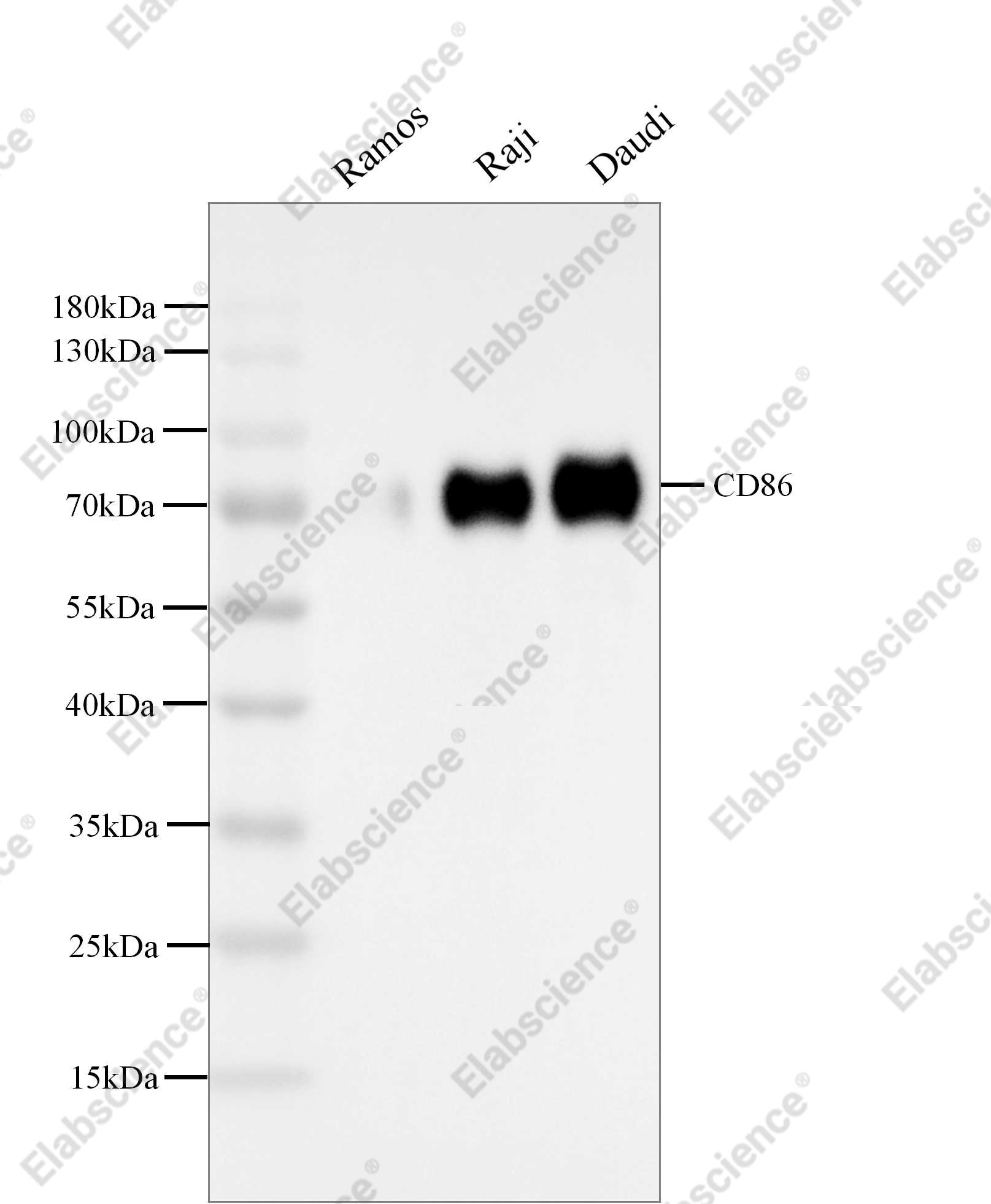 Recombinant CD86/B7-2 Monoclonal Antibody - 1