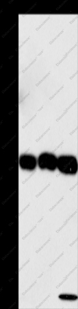 CKAP4 Polyclonal Antibody - 1