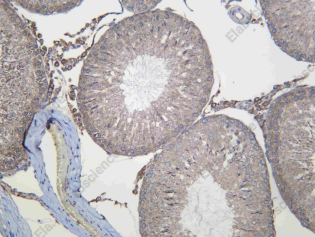 Recombinant PCBP2 Monoclonal Antibody - 3