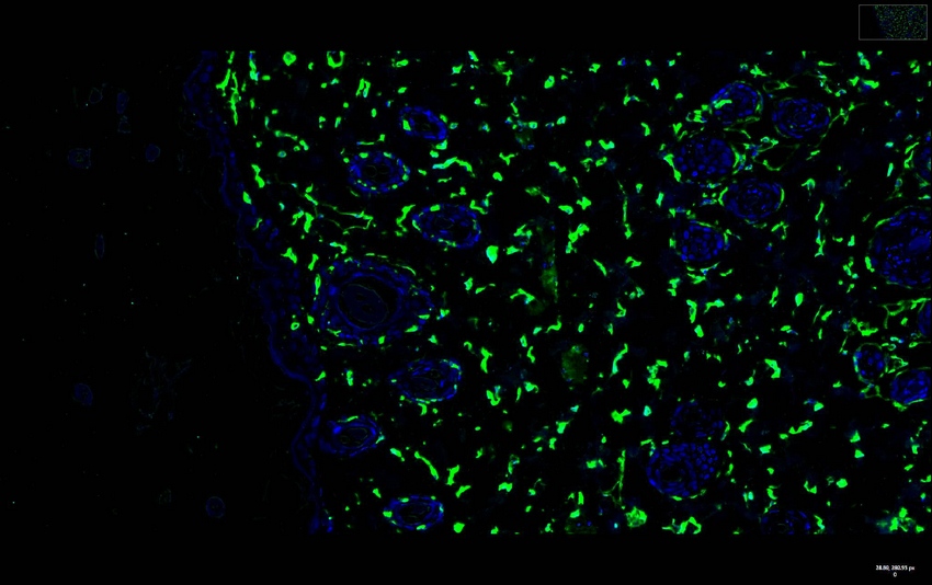 Recombinant Vimentin Monoclonal Antibody - small - 8