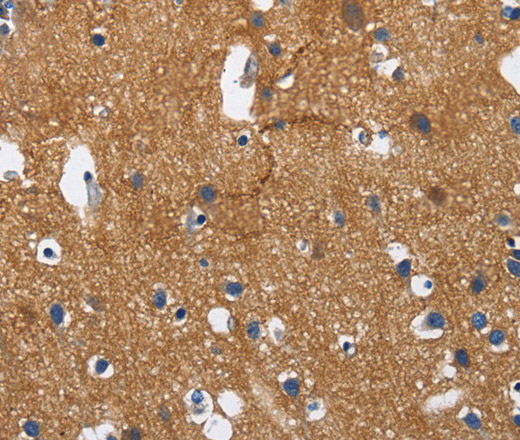 Immunohistochemistry of paraffin-embedded Human brain tissue using CADM3 Polyclonal Antibody at dilution 1:40