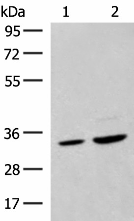 Western blot analysis of Hela cell and Human fetal liver tissue lysates  using SCGN Polyclonal Antibody at dilution of 1:600