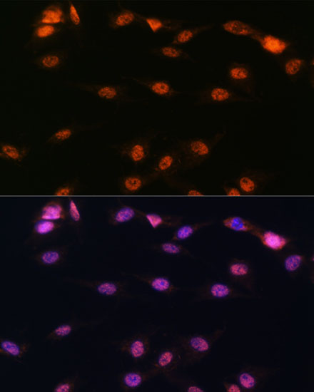 Immunofluorescence analysis of C6 cells using ALOX5 Polyclonal Antibody at dilution of  1:100. Blue: DAPI for nuclear staining.