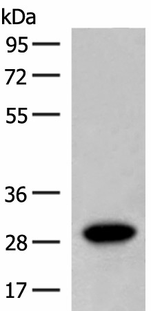 Western blot analysis of Human fetal brain tissue lysate  using SCGN Polyclonal Antibody at dilution of 1:600