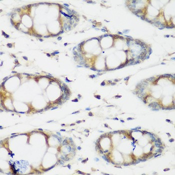 Immunohistochemistry of paraffin-embedded Human colon using BMP2 Polyclonal Antibody at dilution of  1:200 (40x lens).