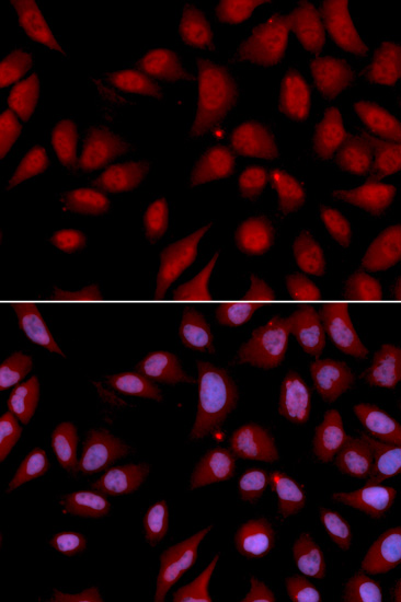 Immunofluorescence analysis of U2OS cells using DLGAP5 Polyclonal Antibody