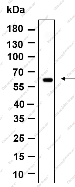 Recombinant Cytokeratin 10 Monoclonal Antibody - 1