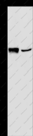 GRPR Polyclonal Antibody - 1