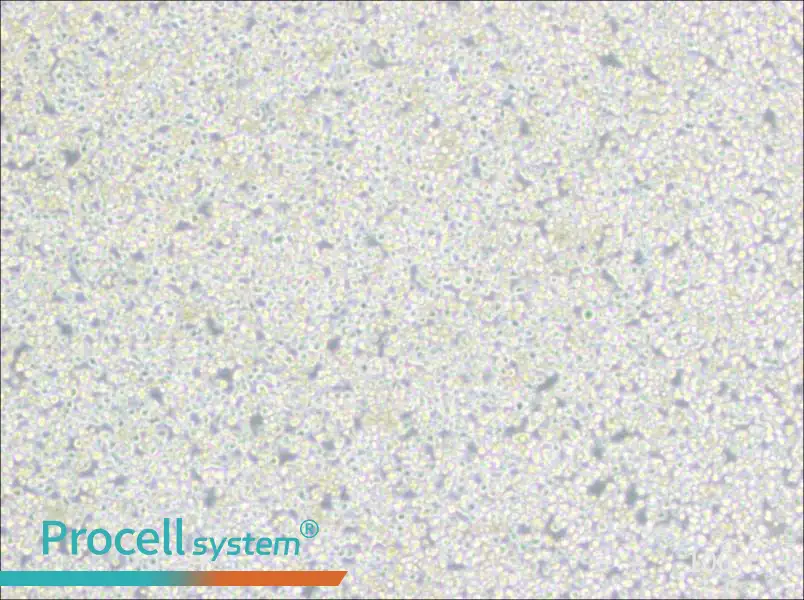 PC 61 5.3 [PC 61; PC 61.5.3] Cell Complete Medium - 1