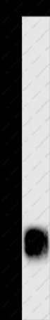 CEBP epsilon Polyclonal Antibody - 1