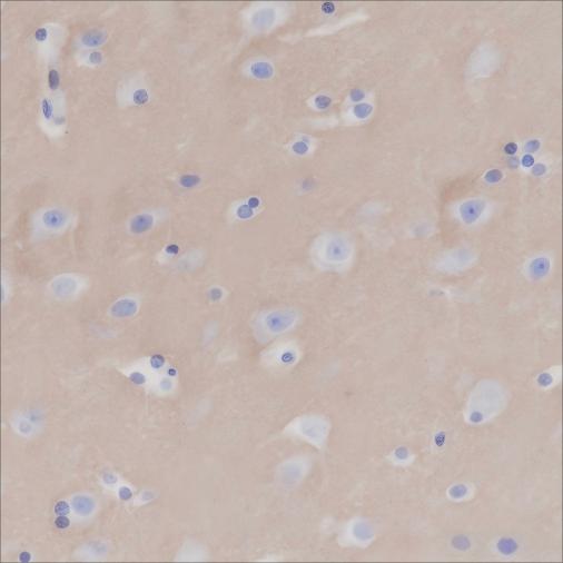 Recombinant CD47 Monoclonal Antibody - 2