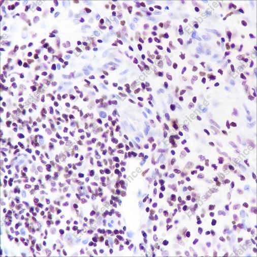 Recombinant IKAROS Monoclonal Antibody - 4
