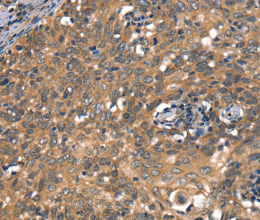 DAAM1 Polyclonal Antibody - 2