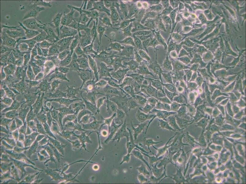 NCI-H3122 Cell Complete Medium - small - 6