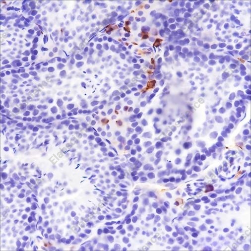 Recombinant Factor XIIIa Monoclonal Antibody - 4