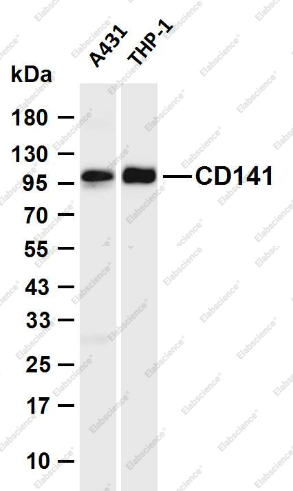 Recombinant Thrombomodulin Monoclonal Antibody - 1