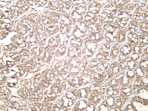 Recombinant 14-3-3 β Monoclonal Antibody - 2