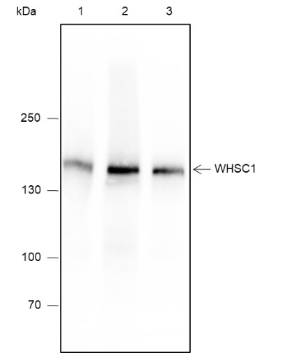 Recombinant WHSC1 Monoclonal Antibody-searchlist-1