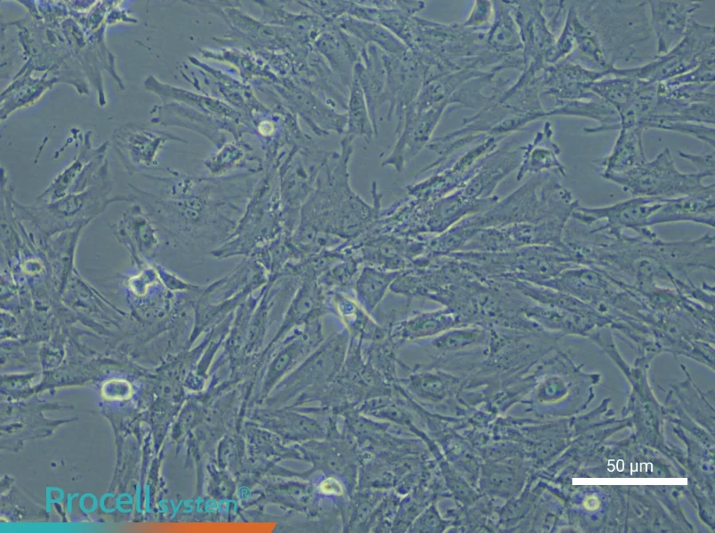 Mouse Pulmonary Artery Smooth Muscle Cell Complete Medium - small - 4