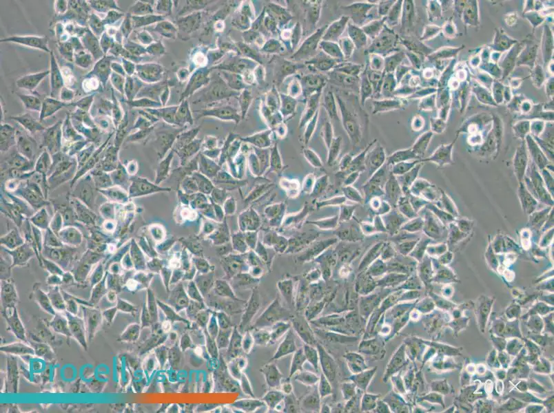 CHP-212 Cell Complete Medium - 5