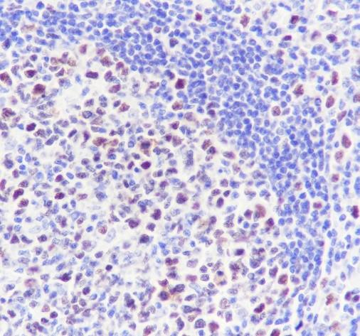 Recombinant p60 CAF1/MPP7 Monoclonal Antibody - small - 2