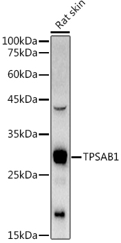 Western blot analysis of extracts of Rat skin using TPSAB1 Polyclonal Antibody at 1:1000 dilution.